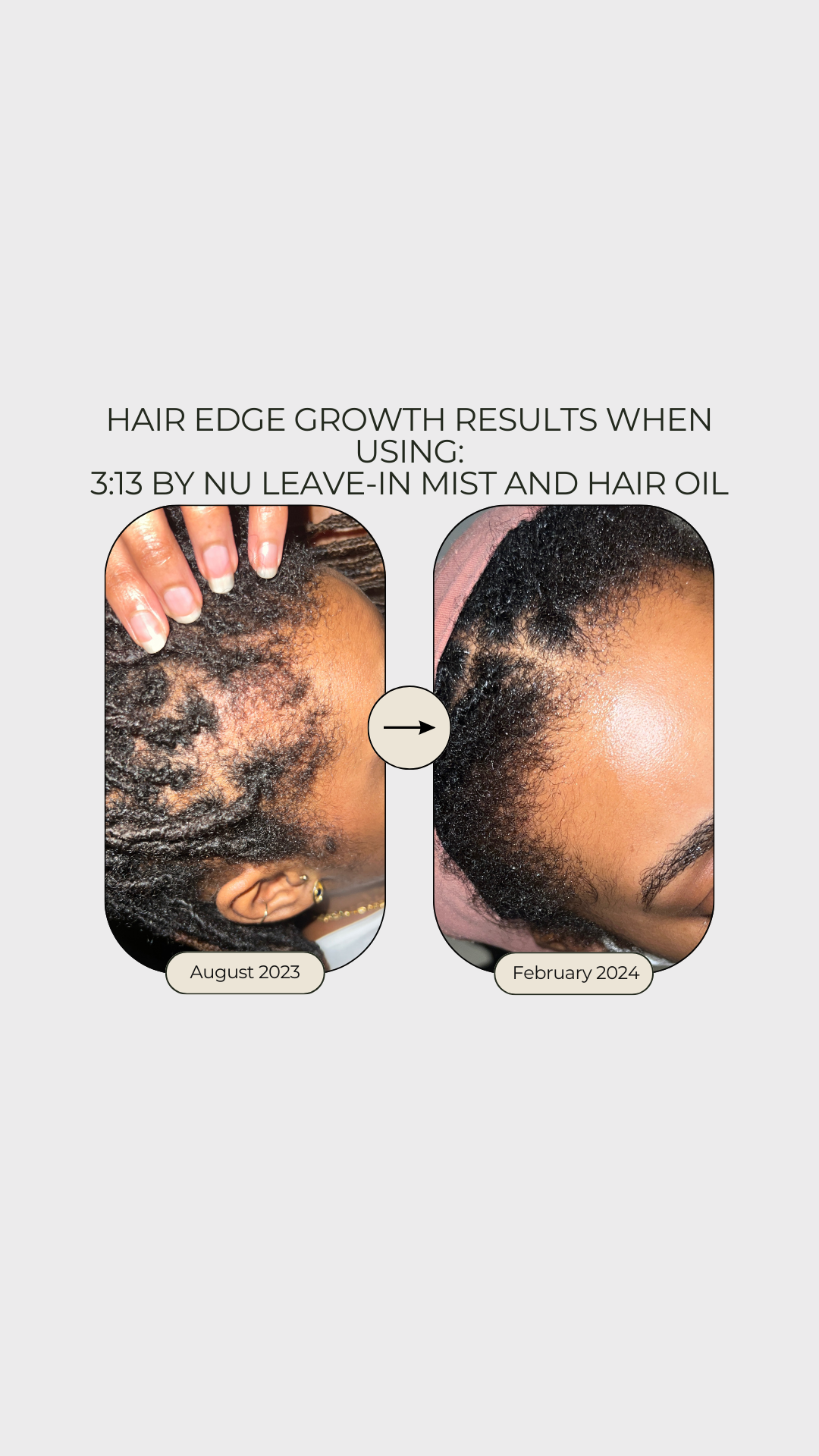 Regrow and Strengthen Hair Growth Oil